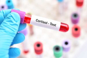 Cortisol Lab Test Tube